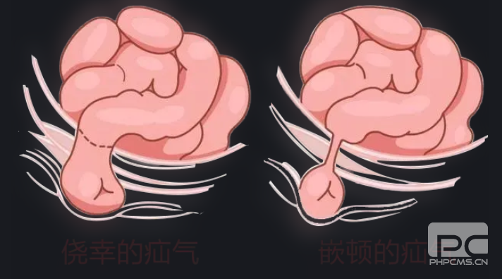 青海东大肛肠医院：小儿疝气要马上手术吗？一文全懂！