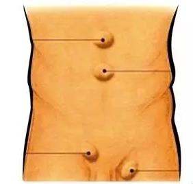 青海东大肛肠医院：疝气的危害有哪些方面